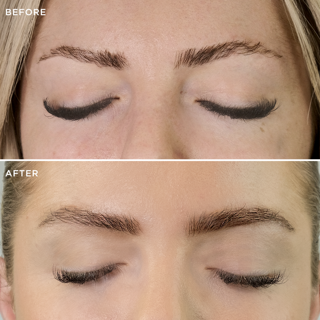 Before and after comparison 1