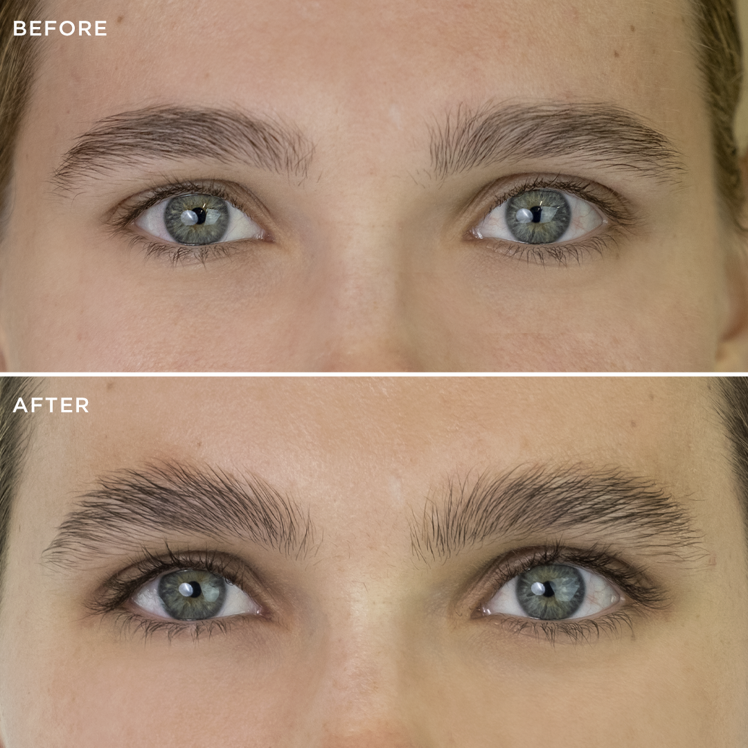 Before and after comparison 3
